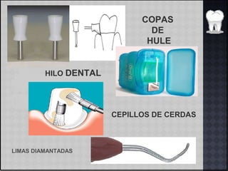 COPAS
DE
HULE
HILO DENTAL
CEPILLOS DE CERDAS
LIMAS DIAMANTADAS
 