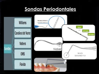 Sondas Periodontales
 