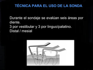 TÉCNICA PARA EL USO DE LA SONDA
Durante el sondaje se evalúan seis áreas por
diente.
3 por vestibular y 3 por linguo/palatino.
Distal / mesial
 
