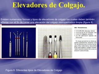 Elevadores de Colgajo.
Existen numerosos formas y tipos de elevadores de colgajo los cuales deben también
afilarse con el fin de hacer una elevación del colgajo mucoperiostico limpia (figura 8).

Figura 8. Diferentes tipos de Elevadores de Colgajo

 