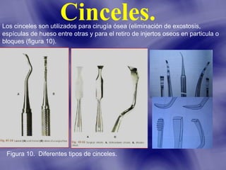 Cinceles.

Los cinceles son utilizados para cirugía ósea (eliminación de exostosis,
espículas de hueso entre otras y para el retiro de injertos oseos en particula o
bloques (figura 10).

Figura 10. Diferentes tipos de cinceles.

 