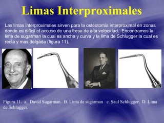 Limas Interproximales
Las limas interproximales sirven para la osteotomia interproximal en zonas
donde es difícil el acceso de una fresa de alta velocidad. Encontramos la
lima de sugarman la cual es ancha y curva y la lima de Schlugger la cual es
recta y mas delgada (figura 11).

Figura 11. a. David Sugarman. B. Lima de sugarman c. Saul Schlugger. D. Lima
de Schlugger.

 