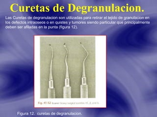 Curetas de Degranulacion.
Las Curetas de degranulacion son utilizadas para retirar el tejido de granulacion en
los defectos intraoseos o en quistes y tumores siendo particular que principalmente
deben ser afiladas en la punta (figura 12).

Figura 12. curetas de degranulacion.

 