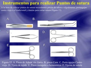 Instrumentos para realizar Puntos de sutura
A la hora de colocar puntos de sutura necesitamos pinzas de adson o algodoneras, portaagujas
castro viejo o el tradicional y tineras para cortar sutura (figura 15)

A.

B.

C .

D.

E.

F.

Figura 15. A. Pinza de Adson sin Garra B. pinza Corn C. Porta agujas Castro
viejo D. Tijera de tejido E. Pinza mosquito o hemostática F. Tijeras de sutura

 
