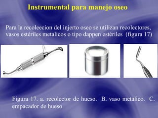 Instrumental para manejo oseo
Para la recoleecion del injerto oseo se utilizan recolectores,
vasos estériles metalicos o tipo dappen estériles (figura 17)

Figura 17. a. recolector de hueso. B. vaso metalico. C.
empacador de hueso.

 