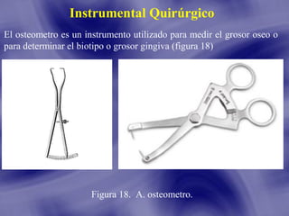 Instrumental Quirúrgico
El osteometro es un instrumento utilizado para medir el grosor oseo o
para determinar el biotipo o grosor gingiva (figura 18)

Figura 18. A. osteometro.

 