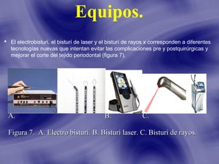 Equipos.
 El electrobisturi, el bisturí de laser y el bisturí de rayos x corresponden a diferentes
tecnologías nuevas que intentan evitar las complicaciones pre y postquirúrgicas y
mejorar el corte del tejido periodontal (figura 7),

A.

B.

C.

Figura 7. A. Electro bisturí. B. Bisturí laser. C. Bisturí de rayos.

 