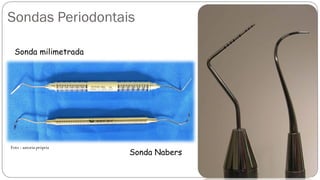 Sondas Periodontais
Sonda milimetrada
Sonda Nabers
Foto : autoria própria
 