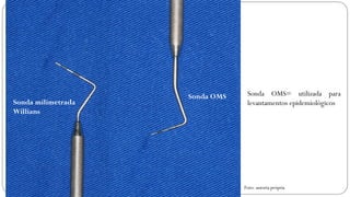 Sonda OMS
Sonda milimetrada
Willians
Sonda OMS= utilizada para
levantamentos epidemiológicos
Foto: autoria própria
 