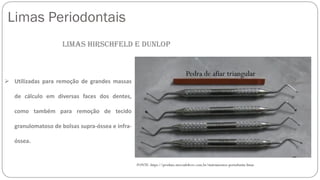 Limas Periodontais
Pedra de afiar triangular
Limas Hirschfeld e Dunlop
➢ Utilizadas para remoção de grandes massas
de cálculo em diversas faces dos dentes,
como também para remoção de tecido
granulomatoso de bolsas supra-óssea e infra-
óssea.
FONTE: https://produto.mercadolivre.com.br/instrumentos-periodontia-limas
 