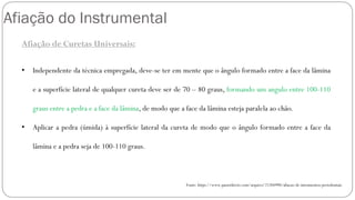 Afiação do Instrumental
Afiação de Curetas Universais:
• Independente da técnica empregada, deve-se ter em mente que o ângulo formado entre a face da lâmina
e a superfície lateral de qualquer cureta deve ser de 70 – 80 graus, formando um angulo entre 100-110
graus entre a pedra e a face da lâmina, de modo que a face da lâmina esteja paralela ao chão.
• Aplicar a pedra (úmida) à superfície lateral da cureta de modo que o ângulo formado entre a face da
lâmina e a pedra seja de 100-110 graus.
Fonte: https://www.passeidireto.com/arquivo/21204990/afiacao-de-intrumentos-periodontais
 