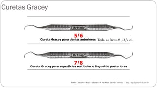 Curetas Gracey
Fonte: CURETAS GRACEY HU FRIEDY PADRAO - Dental Curitibana // http://loja.lojamaisfacil.com.br
Todas as faces M, D,V e L
 