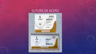 SUTURA DE ACERO
 