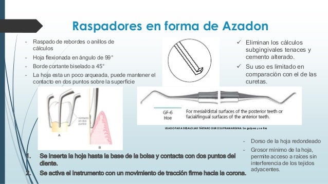 Instrumental y material utilizados en periodoncia