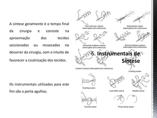A síntese geralmente é o tempo final
da cirurgia e consiste na
aproximação dos tecidos
seccionados ou ressecados no
decorrer da cirurgia, com o intuito de
favorecer a cicatrização dos tecidos.
Os instrumentais utilizados para este
fim são a porta agulhas.
 