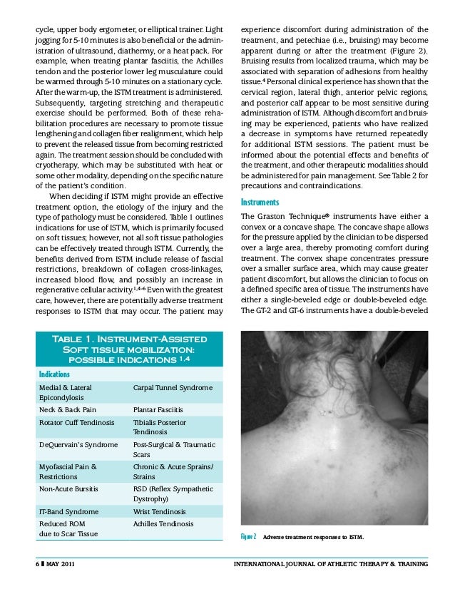 InstrumentAssisted SoftTissue Mobilization