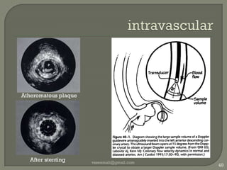 Motorized TEEvaseemali@gmail.com46cardiac anesthesia, cardiac surgery, or intensive care workArray type: Phased Array SectorScan angle: 90°Frequency range: 2-8 MHzInsertion Depth: 1000 mmDiameter: 12.5 mm