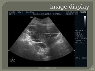 38mm for Regional Anesthesiavaseemali@gmail.com47slightly larger footprint 38mm