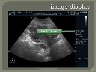 guide needle placement Main SpecificationsArray Type: Convex ArrayScan angle/width: 38mmFrequency range: 5-10MHz