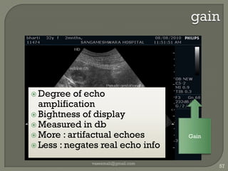 intravascularvaseemali@gmail.com49Atheromatous plaqueAfter stenting