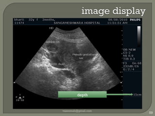 image displayvaseemali@gmail.com51Manufacturer 