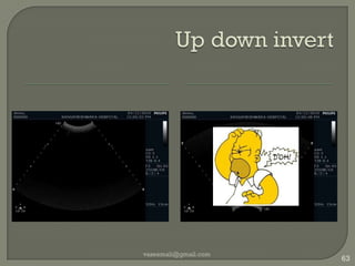 image displayvaseemali@gmail.com55Profile / Preset