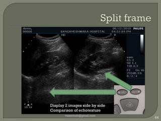 image displayvaseemali@gmail.com56Transducer in use