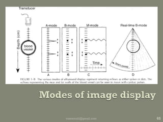 gainDegree of echo amplificationBightness of displayMeasured in dbMore : artifactual echoesLess : negates real echo infovaseemali@gmail.com57Gain 