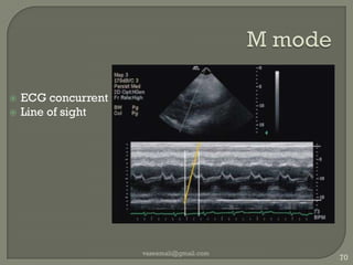 Shows excellent shadows and highlights. Left right invertvaseemali@gmail.com62
