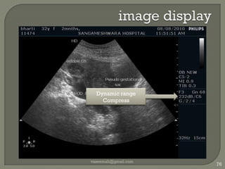 M modeBrightness α intensity of reflected signalPosition of moving reflectorsRapid motion :  cardiac valvesvaseemali@gmail.com68Essentials of medical ultrasound: a practical introduction to the principles By Michael H. Repacholi, Dierdre A. Benwell