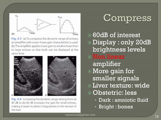 M modeECG concurrentLine of sightvaseemali@gmail.com70