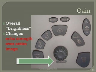 Calipers/measureLengthArea Volume vaseemali@gmail.com73Calipers 