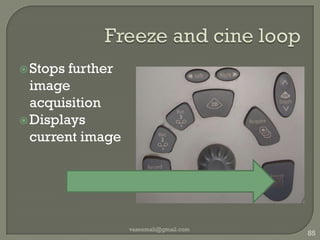 Dynamic range/compressRatio of largest/smallest echoMeasured in dBFrom tissues 100-150dBDecreases as signals into USGRejection filter : rejects very small & very large echoesTGC60 dB at ADC level vaseemali@gmail.com77