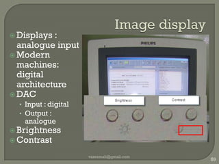 Gain vaseemali@gmail.com81Overall “brightness”Changes echo strength over entire image