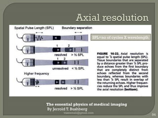 Cine loopTrack ballNot USG specificUsed in CT MRI PETStill images in successionPlayed back Dynamic movement :Cardiac  motionDoppler studiesRecorded as moviePhysician/cardiologist can view latervaseemali@gmail.com86