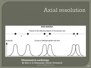 Image processorInterpolation between scan linesLog compressPost processingSpatial filteringReduce noiseEnhance edgesTemporal filtering : frame avg/persistReduces image noiseImage demonstrates a lagReduction in temporal resolutionvaseemali@gmail.com87