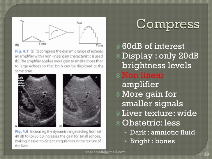 Ultrasound Instrumentation Physics