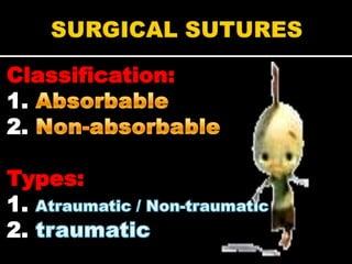 Classification:
1.
2.

Types:
1.
2.
 