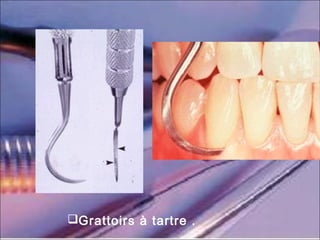 Grattoirs à tartre .
 