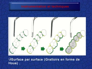Instrumentation et techniques
Surface par surface (Grattoirs en forme de
Houe) .
 