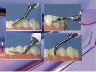 Instrumentation en medecine dentaire