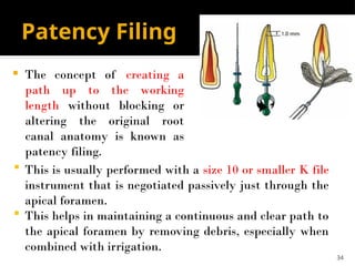 INSTRUMENTATION-OF-THE-ROOT-CANAL-pptx.pptx