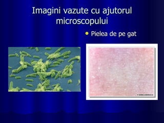 Imagini vazute cu ajutorul microscopului Pielea de pe gat 