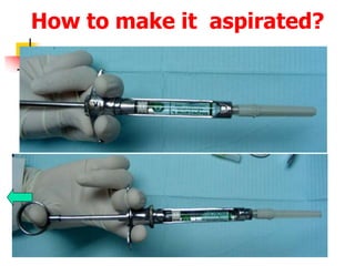 How to make it aspirated?
 