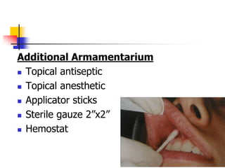 Additional Armamentarium
 Topical antiseptic
 Topical anesthetic
 Applicator sticks
 Sterile gauze 2”x2”
 Hemostat
 