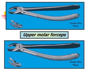 Upper molar forceps
 