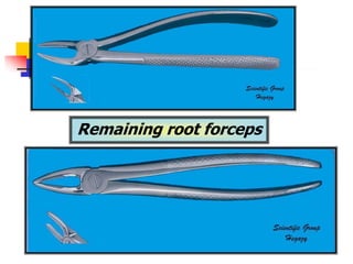 Remaining root forceps
 