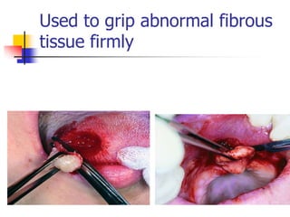 Used to grip abnormal fibrous
tissue firmly
 