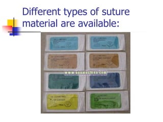 Different types of suture
material are available:
 
