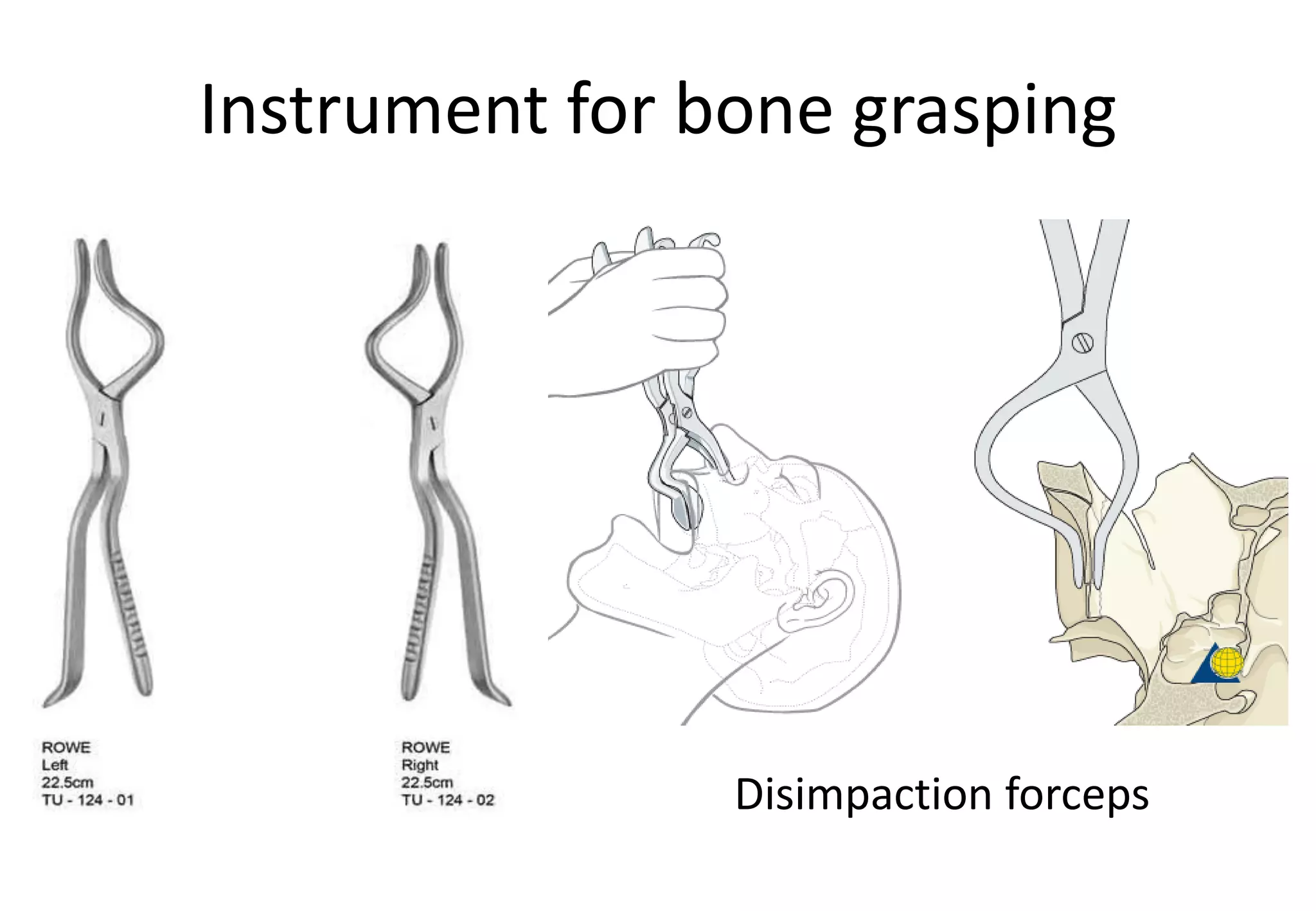 Instrument in oral surgery | PDF